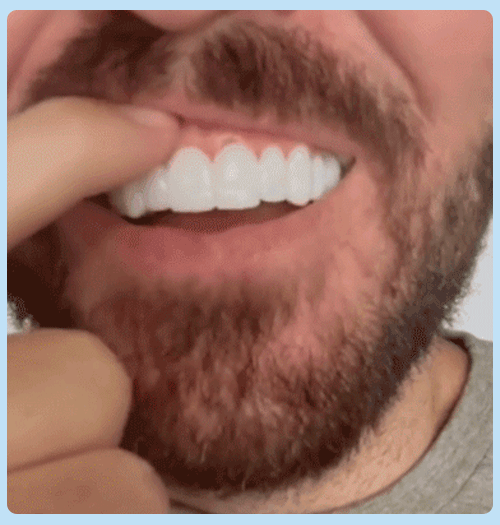 ابتسامتك بتتغيّر بثواني! 😱 جرب Snap-On Smile